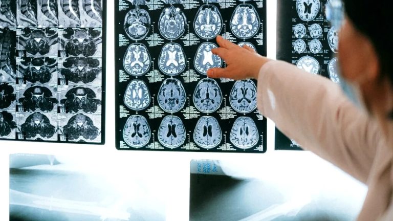 Descoperire în neuroștiință: un cercetător german explică cum funcționează sistemul de navigație al creierului uman