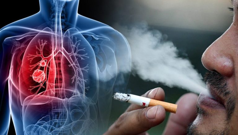 Medic primar pneumolog: Există antrenori care recomandă sportivilor să fumeze, în special înainte de competiții.