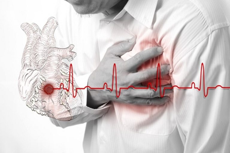 S-a prezentat la medic la două zile după infarct, convins că la 36 de ani nu este în pericol, însă a murit. Medicii trag un semnal de alarmă: tot mai mulți tineri suferă de boli cardiace. „Majoritatea sunt fumători sau obezi”